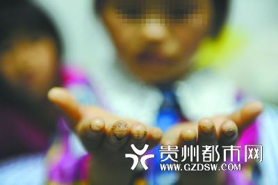 指尖被針扎得傷痕累累。