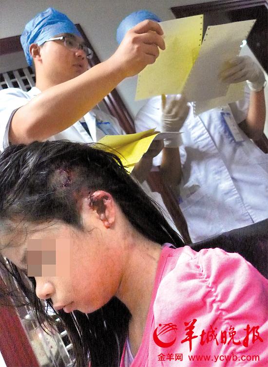 受傷的11歲女孩頭發(fā)被卷入扶梯，耳朵被嚴(yán)重拉傷，需手術(shù)。