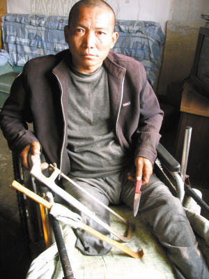 鄭艷良就是用這幾樣簡(jiǎn)陋工具，給自己做了右腿截肢手術(shù)。