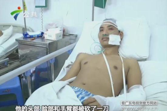 另一名傷者頭部、臉部和手臂都被砍了一刀。(視頻截圖)