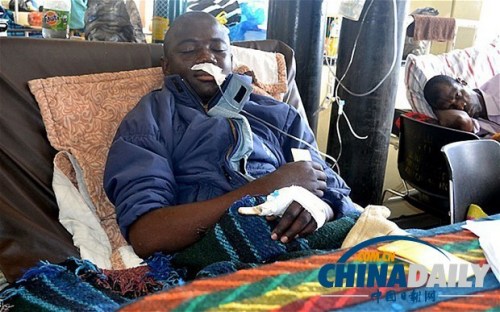 雖然已經(jīng)在醫(yī)院接受了近一個(gè)月的恢復(fù)治療，卡托卡的身體仍然非常虛弱。