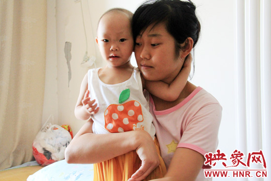 孩子和媽媽在一起，她的右眼已經(jīng)失明。