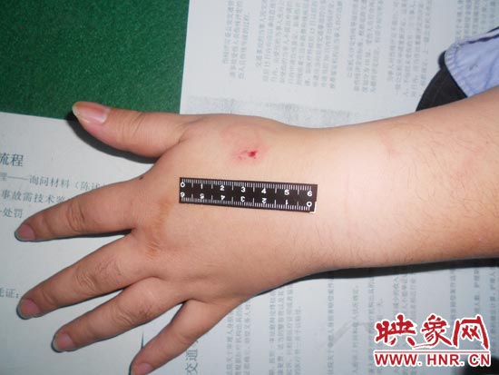 為幫助無證駕駛的朋友逃避處罰，新鄉(xiāng)的王某竟對(duì)執(zhí)勤民警大打出手，還將一名民警的手臂咬傷