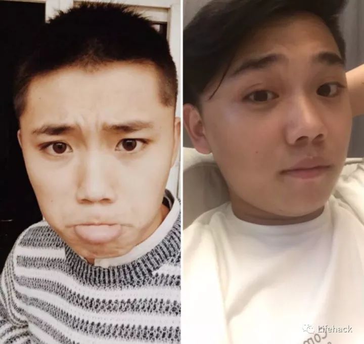 長胖20斤，臉型怎么變？這些例子看完扎心了！