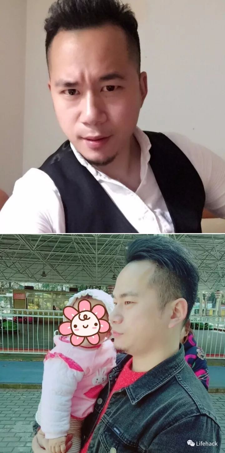 長胖20斤，臉型怎么變？這些例子看完扎心了！