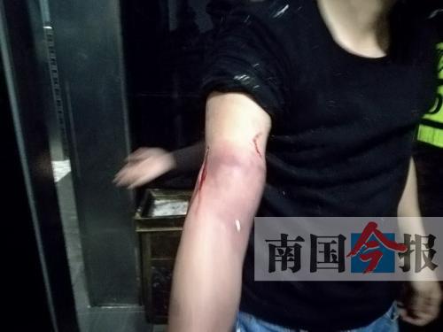 覃先生手臂被卡的部位受傷流血，所幸傷勢無大礙。 通訊員 王建民 攝