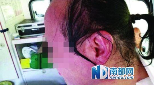 涉事教師遭熱水潑臉后的照片。