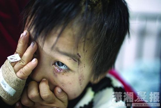 1月13日，湖南省兒童醫(yī)院，4歲的源源用手蒙住了眼睛。