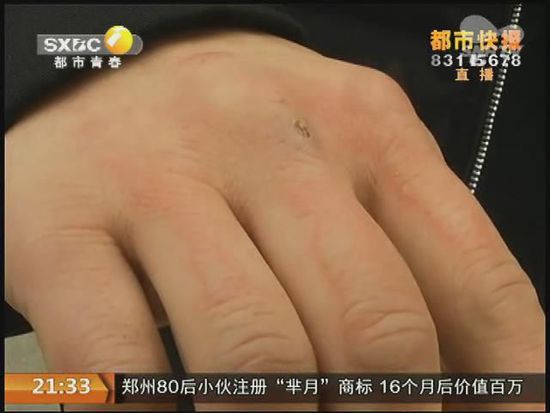 說到這足療拔罐，估計(jì)大伙都不陌生，但是想起4號晚上的拔罐的經(jīng)歷，呂先生現(xiàn)在想起來，還心有余悸。