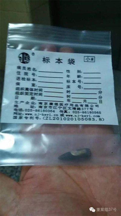 經(jīng)警方鑒定，秦女士體內(nèi)取出的子彈系56式步槍射出 。 受訪者供圖