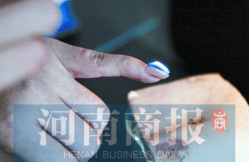 將指甲油涂在指甲上，靠近火焰時被引燃了